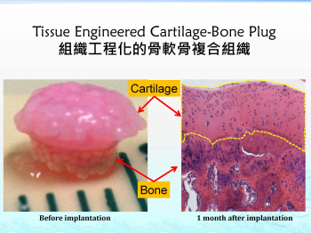 （左）骨髓間質幹細胞，連同生物材料，生長成一個組織工程骨軟骨複合組織。（右）在動物的膝關節軟骨損傷移植後一個月，再生的具有適當結構組織的透明軟骨，骨-軟骨界面和底層骨組織。